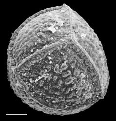 Isoetes kirkii. SEM proximal view of macrospore showing trilete markings and tubercled surface. From photos by D.M. Britton attached to WELT P005837/A. Scale bar = 100 μm.
 Image: J.C. Stahl © Te Papa CC BY-NC 3.0 NZ